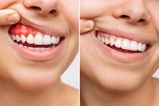 🦷 5 Mistakes You Make Every Morning Without Realizing It