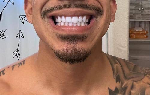 Dentists’ Tips to Keep Your Teeth White Longer 🦷✨