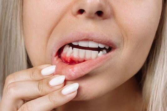 🦷 Ignoring Your Smile Can Cost You Dearly: Here’s Why